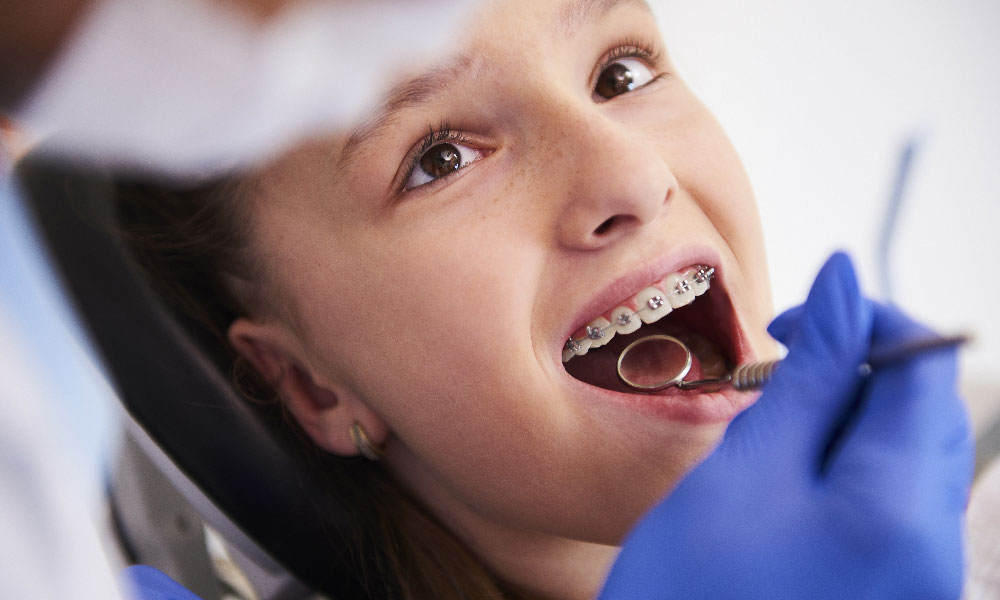 Tratamiento de Ortodoncia en Concepción y Santiago